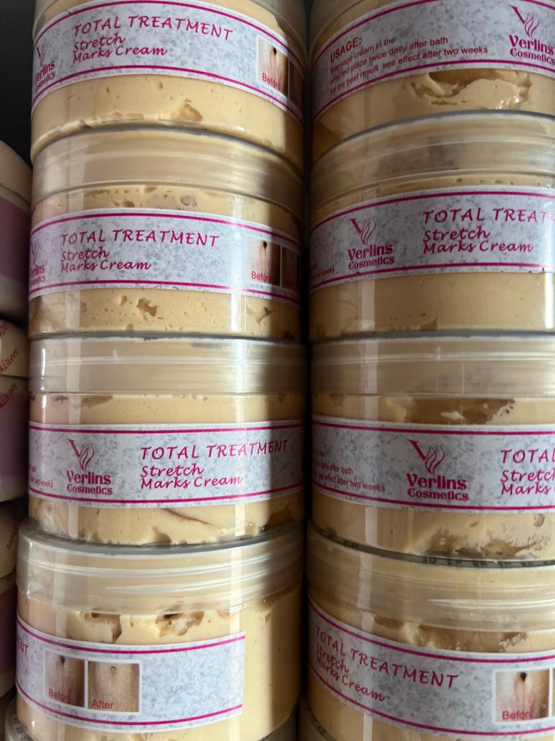 WhatsApp Image 2026-04-16 at 13.33.58 Stretch Mark Body Butter - Image 1